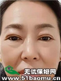 L(zhng)ɳ߅סұķ