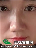 ´ɩ